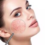 skin problems 3