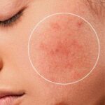 skin problems1